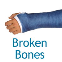 Broken Bones